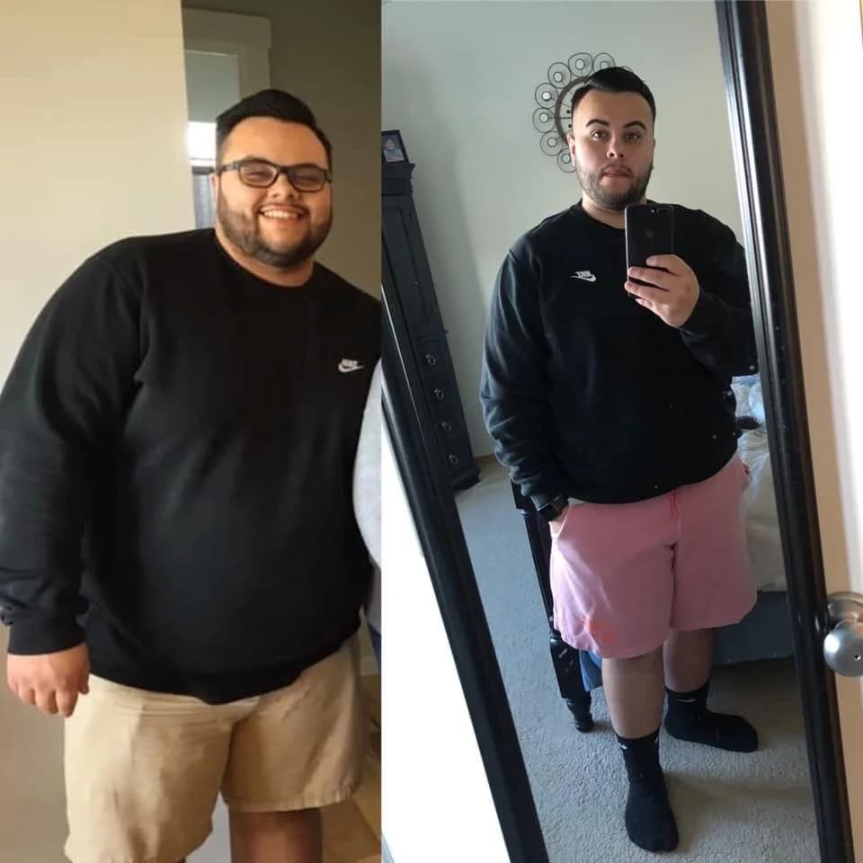 Daniel, age 25: before photo on the left and after photo on the right