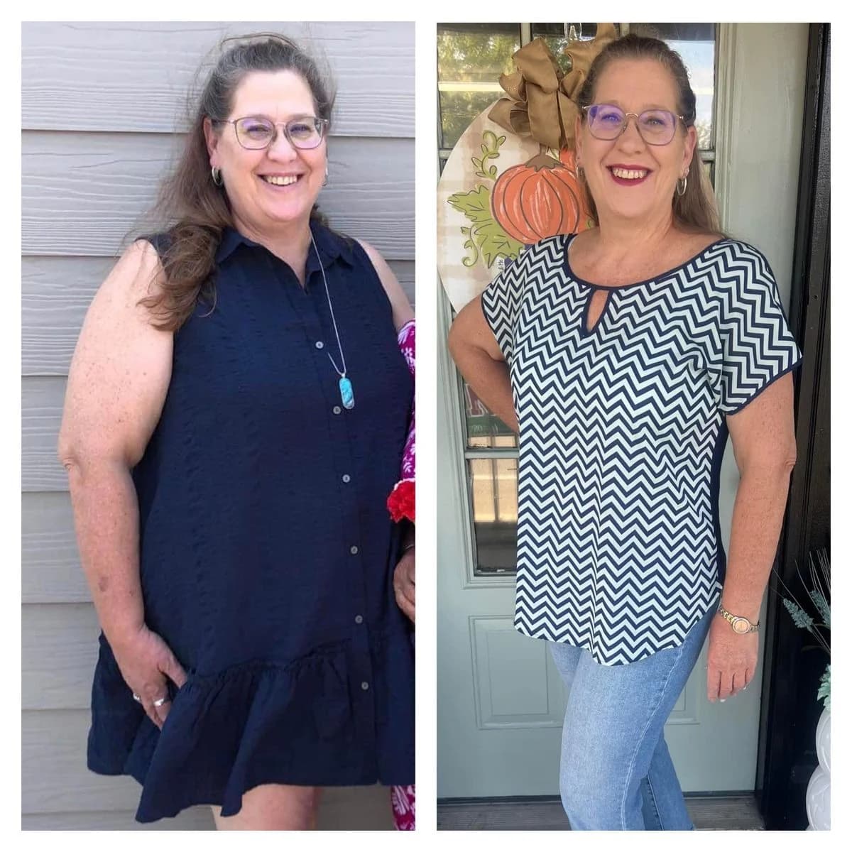 Lauren, age 46: before photo on the left and after photo on the right