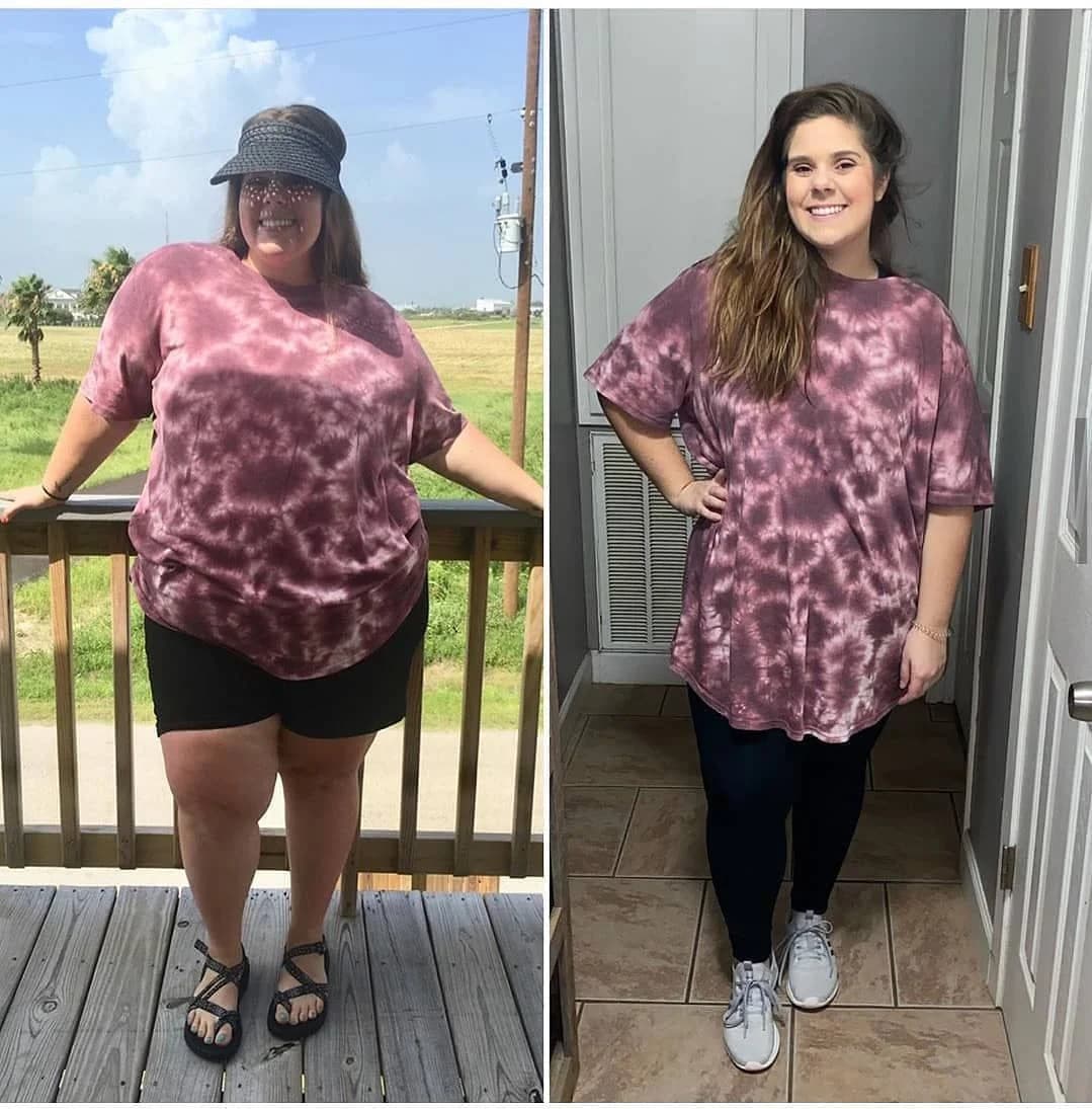 Emily, age 32: before photo on the left and after photo on the right