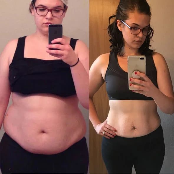 Audra, age 22: before photo on the left and after photo on the right